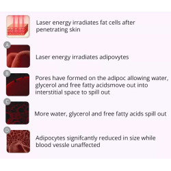 Ultragarso kavitacijos vakuuminis RF Bio lipo lazerinis aparatas