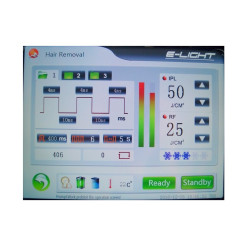 IPL  ND YAG lazeris RF 3in1