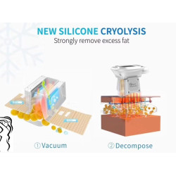 Krioterapijos kriolipolizės RF Lipo Lazerio aparatas