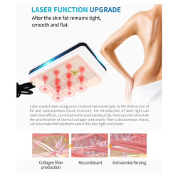 Krioterapijos kriolipolizės RF Lipo Lazerio aparatas