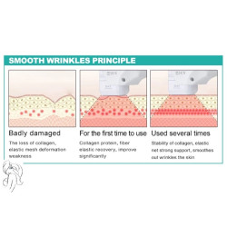 HIFU Veido kūno liekninimo formavimo aparatas