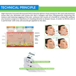 HIFU Veido formavimo aparatas