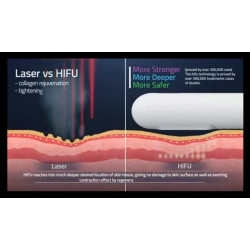 HIFU makšties stangrinimo aparatas