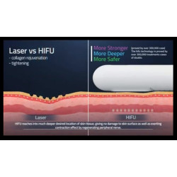 HIFU makšties stangrinimo aparatas