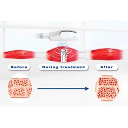 Riebalų pašalinimas ir kūno linijų formavimas