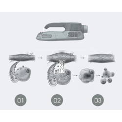 Riebalų pašalinimas ir kūno linijų formavimas