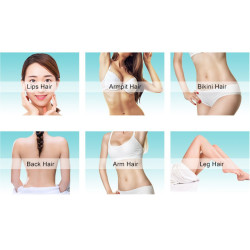 Epiliacijos diodo lazeris 808 nm