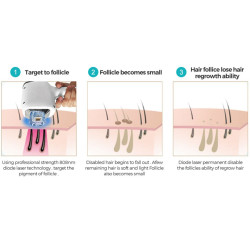 Epiliacijos diodo lazeris 808 nm