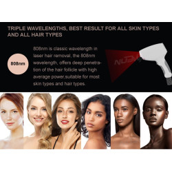 Epiliacijos diodo lazeris 808 nm