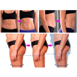 Riebalų pašalinimas ir kūno linijų formavimas