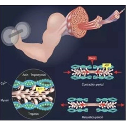 Riebalų pašalinimas ir kūno linijų formavimas