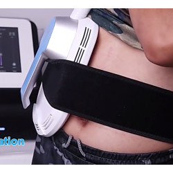 Riebalų pašalinimas ir kūno linijų formavimas