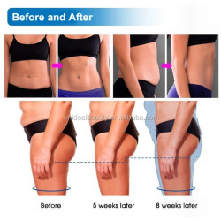 Riebalų pašalinimas ir kūno linijų formavimas