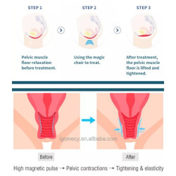 Riebalų pašalinimas ir kūno linijų formavimas