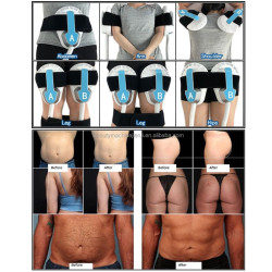 Riebalų pašalinimas ir kūno linijų formavimas