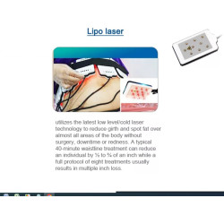 Krioterapijos kriolipolizės RF Lipo Lazerio aparatas