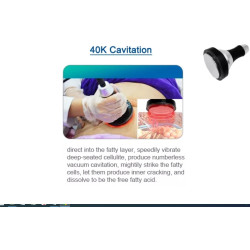 Krioterapijos kriolipolizės RF Lipo Lazerio aparatas