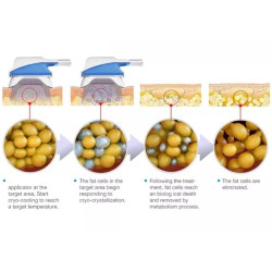Krioterapijos kriolipolizės RF Lipo Lazerio aparatas