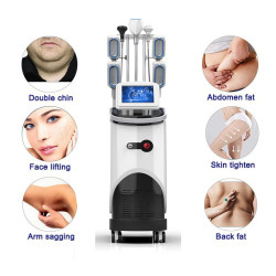 Krioterapijos kriolipolizės RF Lipo Lazerio aparatas