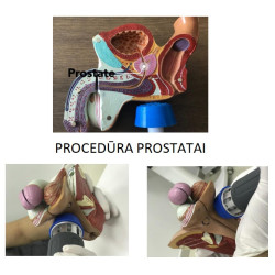 Smūginės, vibracinės bangos terapijos aparatas