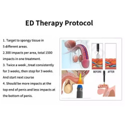 Smūginės, vibracinės bangos terapijos aparatas