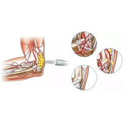 Smūginės, vibracinės bangos terapijos aparatas