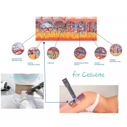 Smūginės, vibracinės bangos terapijos aparatas