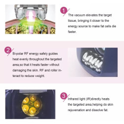 Velashape 3 Vakuumo aparatas 4-1