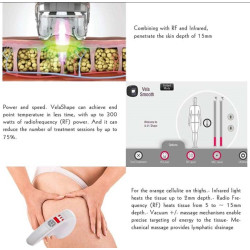 Velashape 3 Vakuumo aparatas 4-1