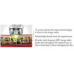 Velashape vakuumo lazerio aparatas 5-1