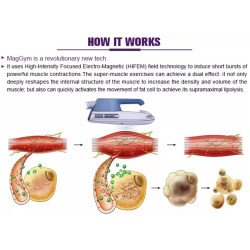 Riebalų pašalinimas ir kūno linijų formavimas