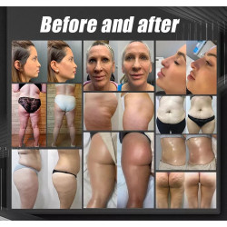 Velachape V9 vakuumo aparatas