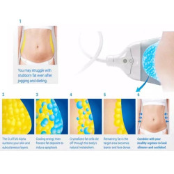 Krioterapijos kriolipolizės 360 aparatas