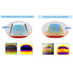 Krioterapijos kriolipolizės 360 aparatas