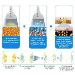 Cryo Freezing + HI-EMT lieknėjimo aparatas 2–1