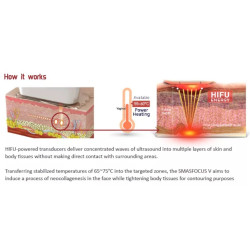 HIFU Veido Kūno ultragarsinis liposakcinis aparatas