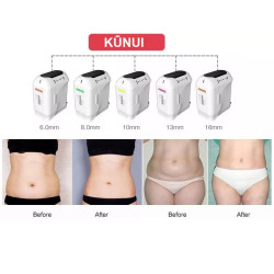 HIFU veido kūno liekninimo formavimo aparatas 3D