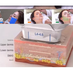 HIFU veido kūno liekninimo formavimo aparatas 7D