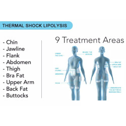 Krioterapijos kriolipolizės 360 aparatas