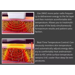 Veido kūno kontūravimo riebalų šalinimo RF aparatas