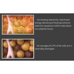 Veido kūno kontūravimo riebalų šalinimo RF aparatas