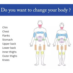 Lazerinis 1060 nm kūno lieknėjimo kontūravimo aparatas