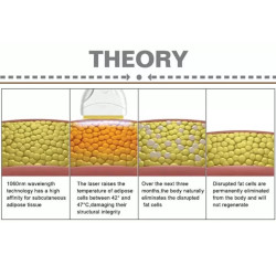 Lazerinis 1060 nm kūno lieknėjimo kontūravimo aparatas