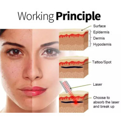 Pikosekundinis lazeris   532 755 1064 nm