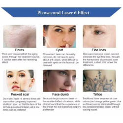 Pikosekundinis lazeris   532 755 1064 nm