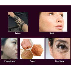 Pikosekundinis lazeris   532 755 1064 nm