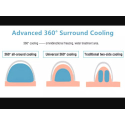 Krioterapijos kriolipolizės 360 aparatas