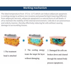 Kriolipolizės kūno lieknėjimo formavimo aparatas