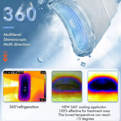 Kriolipolizės 4D aparatas