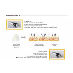 Frakcinis radio dažnio aparatas 2-1